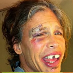 Así quedó Steven Tyler