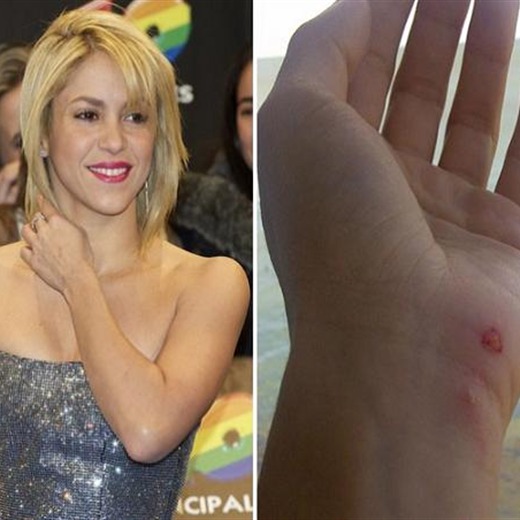 Atacaron a Shakira