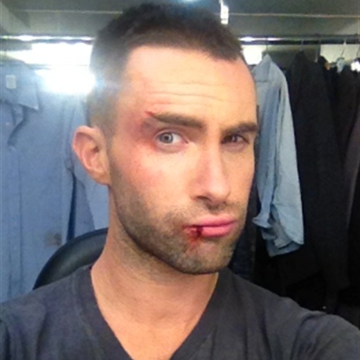 Golpearon a Adam Levine