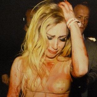 Lady Gaga en problemas