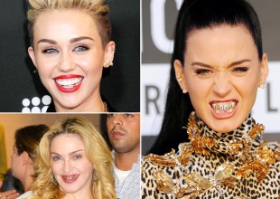 Grillz, la moda de los "dientes de metal"