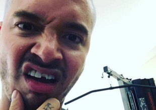 J Balvin se rompió un diente y las redes enloquecieron