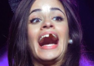 ¡Un fan le quebró un diente a Camila Cabello!