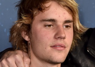 El terrible accidente de tránsito de Justin Bieber